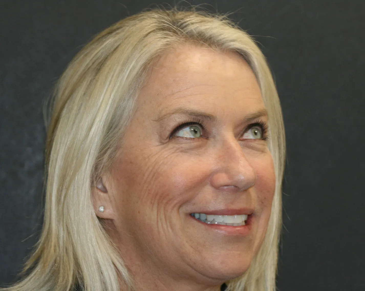 Preventive dentistry patient smiling