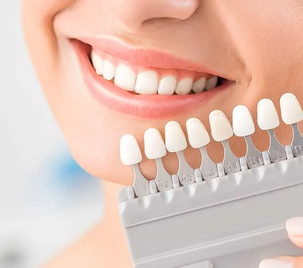 Dental bonding procedure