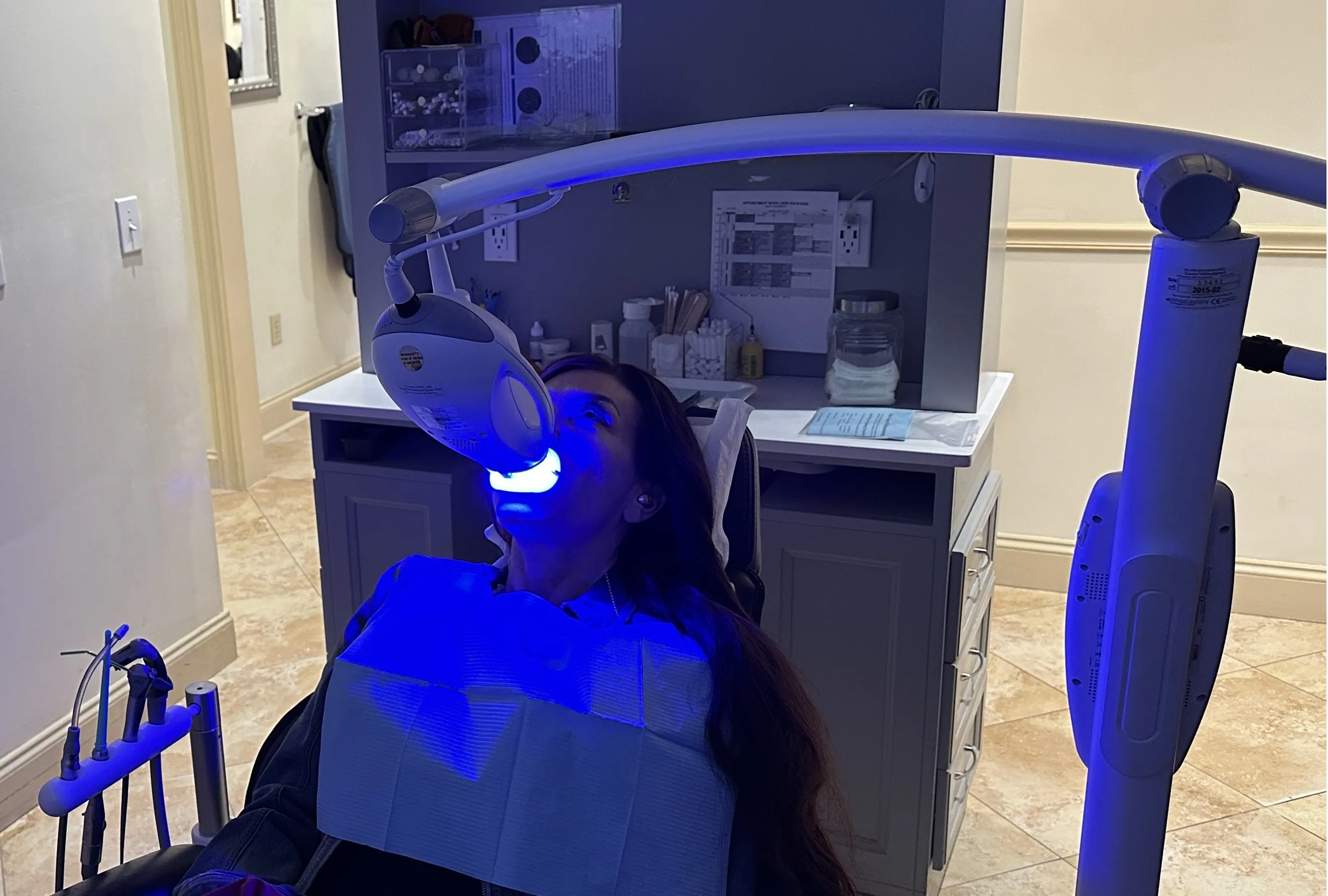 Teeth whitening results