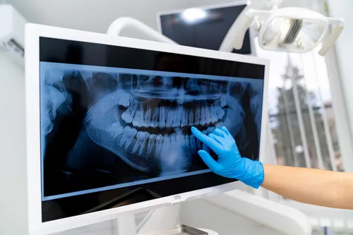 Dentist reviewing a digital panoramic X-ray on screen