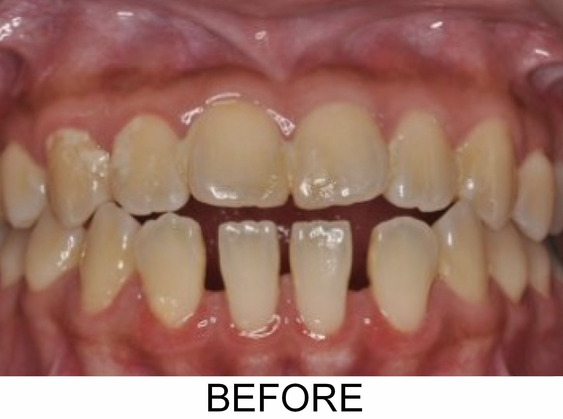 Opening Space - Before