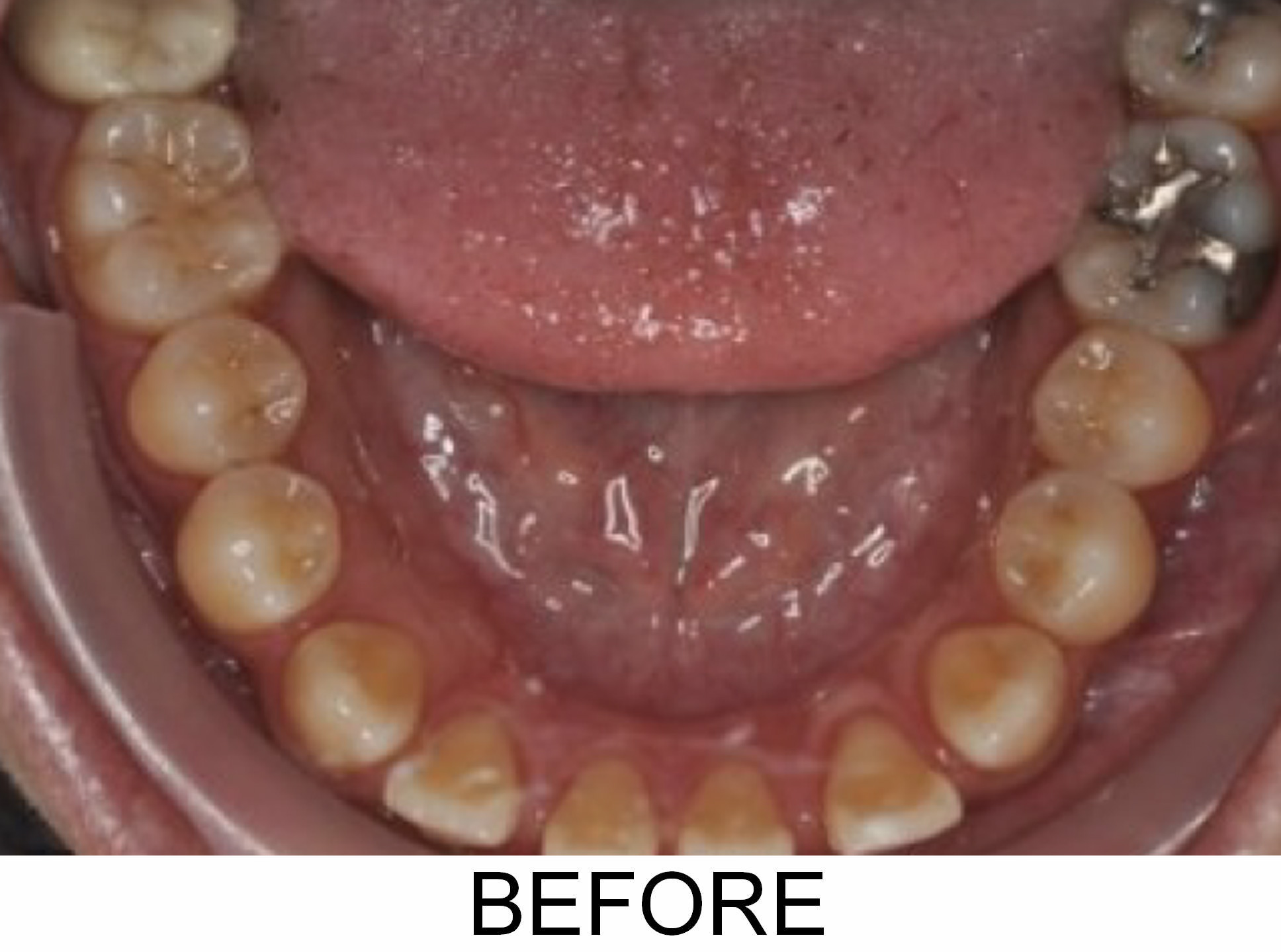 Opening Space - Before