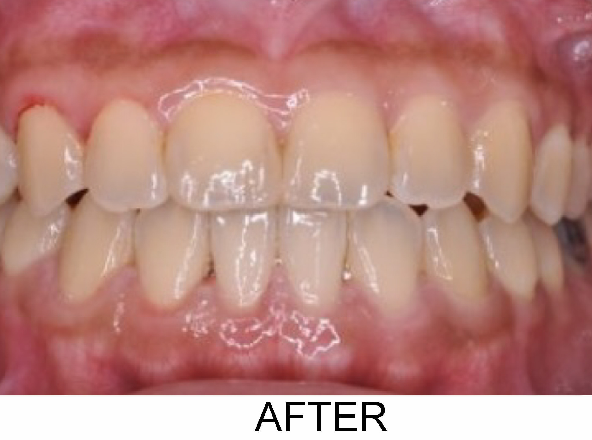 Opening Space - After