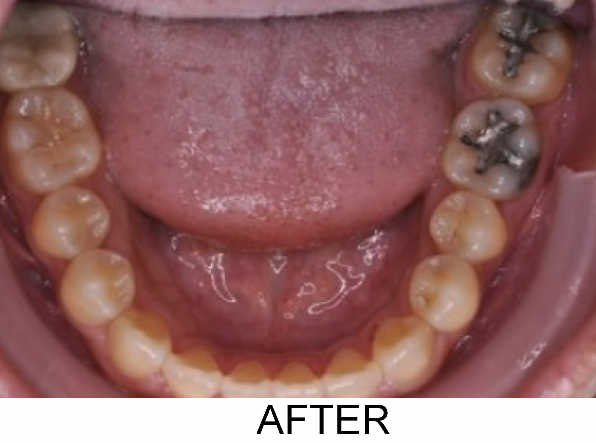 Opening Space - After